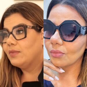 Lipo Enzimática de Papada